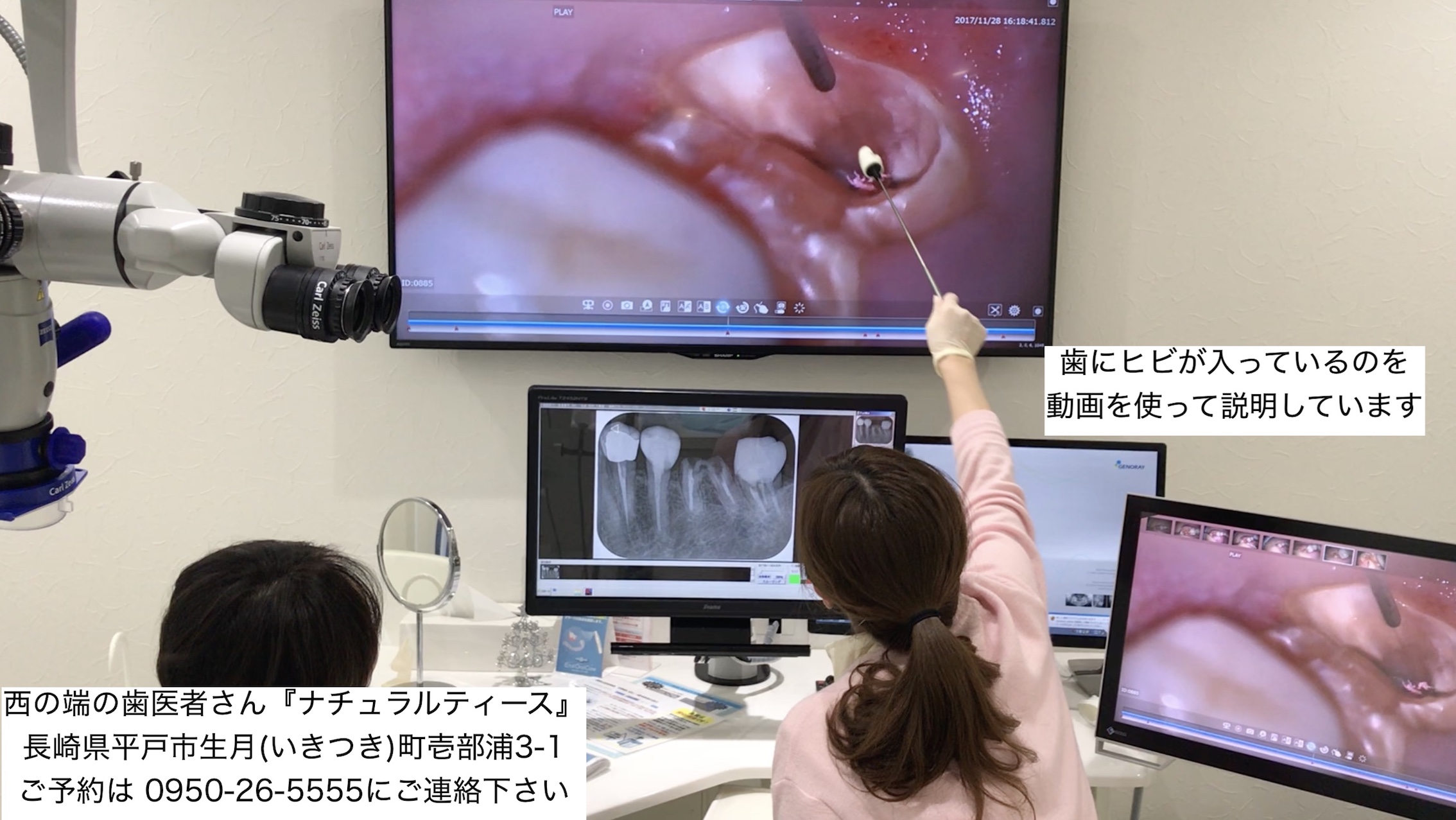 歯医者 動画で説明 マイクロスコープ 顕微鏡 長崎 平戸 佐世保 松浦